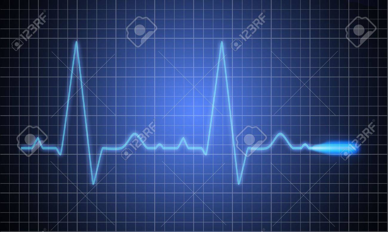 medical-heart-monitor